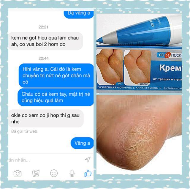 Kem Kpem Nga Trị Nứt, Nẻ Gót Chân Dưỡng Thể-1