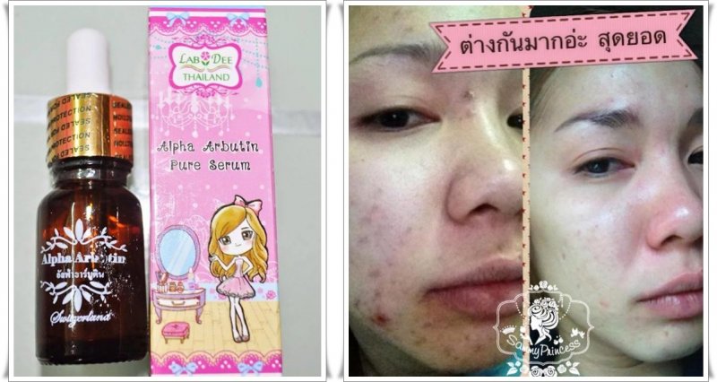 Serum Alpha Arbutin Trị Thâm, Mụn, NámThái Lan Chăm Sóc Mặt-1