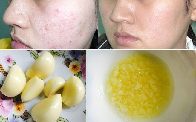 Serum Tỏi Theherbalcup Chăm Sóc Mặt-1
