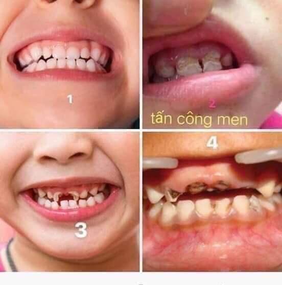 TINH DẦU DẠ THẢO LIÊN TRỊ HÔI MIỆNG ĐAU RĂNG Dưỡng Thể-1